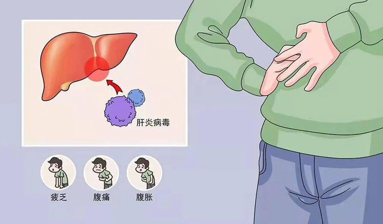 病毒性肝炎的症状有哪些