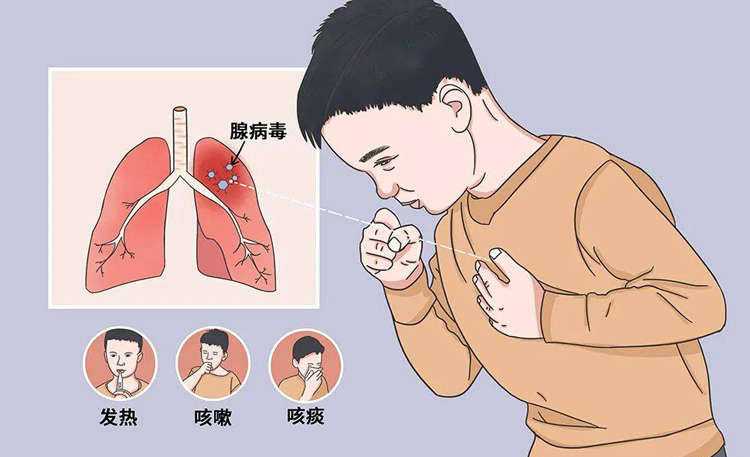 肺炎是什么原因引起的