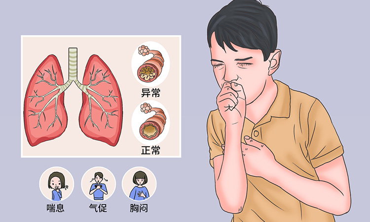 过敏性哮喘有哪些症状