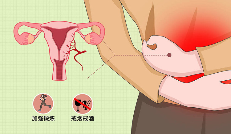 子宫内膜异位症有什么症状