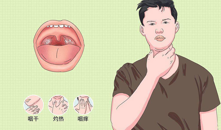 慢性扁桃体炎有什么症状